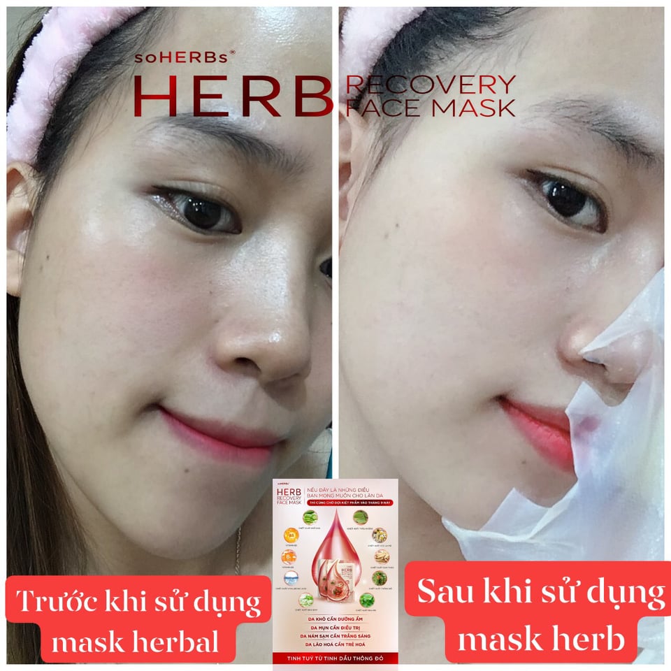 Mặt Nạ HERB Recovery Face Mask soHERBs
